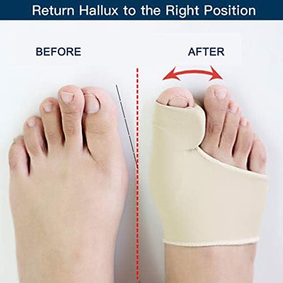 Theroflex© Premium Bunion Corrector: 1 Pair (2 Correctors) DPD1