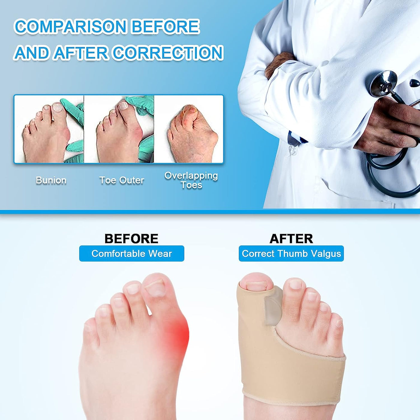 Theroflex© Premium Bunion Corrector: 1 Pair (2 Correctors)